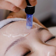 CIT Needling